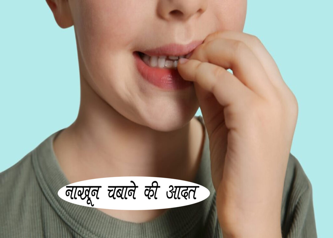 बच्चों में नाखून चबाने की आदत, कैसे रोकें और क्यों ज़रूरी है|Ways to quit nail biting